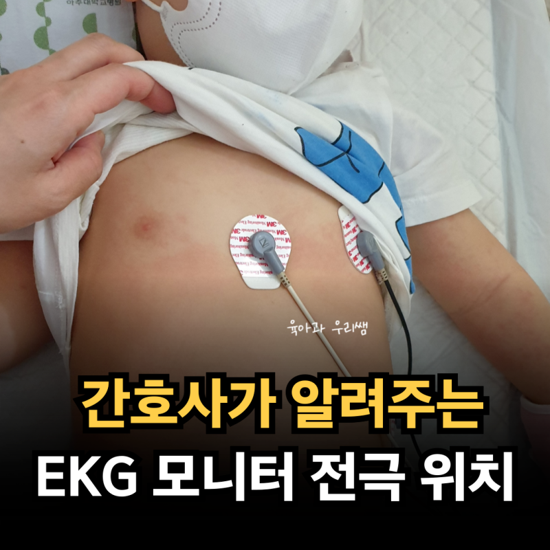EKG 부착 위치, 심전도 모니터 흰검빨 전극 위치