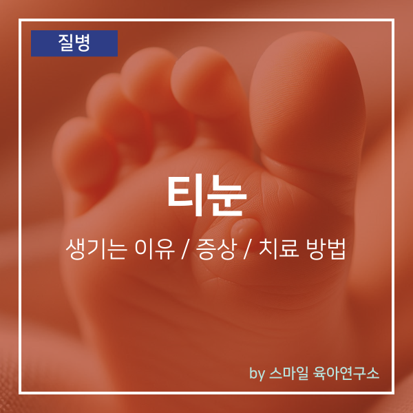 아기 티눈 제거 치료 방법 및 생기는 이유