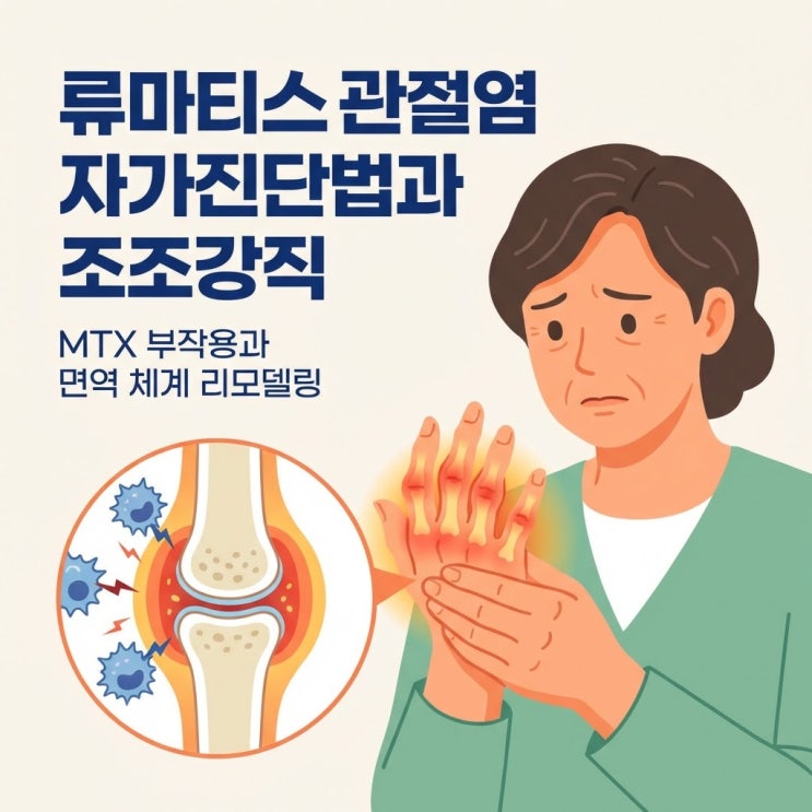  류마티스 관절염 자가진단법과 초기 증상, 원인 (MTX 메토트렉세이트 부작용)