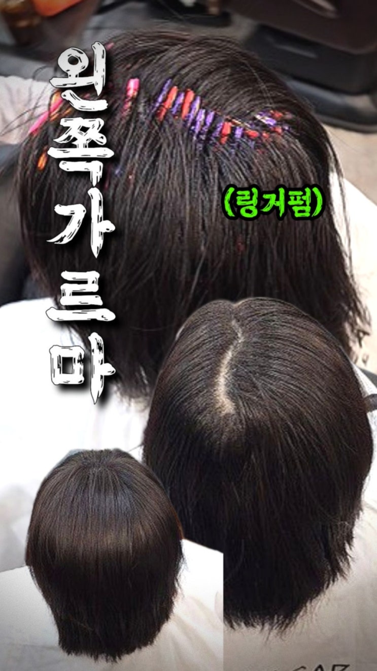  갈라지는 가르마와 납작한 뒤통수 고민? 링거펌으로 완성하는 40대 여성 볼륨