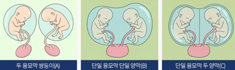 [ep.6] 태아보험 가입 후기 // 일란성 쌍둥이도 할 수 있다!