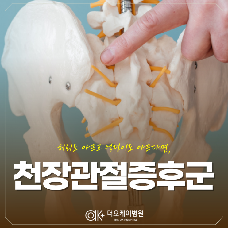  화천정형외과, 허리도 아프고 엉덩이도 아프다면 천장관절증후군?