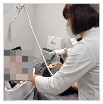  흑자없애는법 루비 레이저로 피부 관리