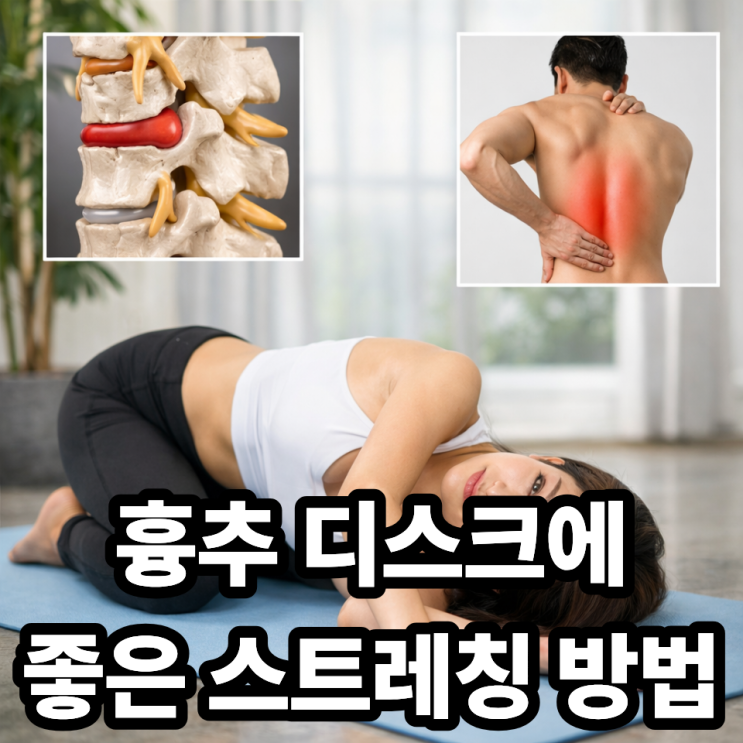  흉추 디스크에 좋은 스트레칭 방법, 등 통증 줄이는 간단 운동