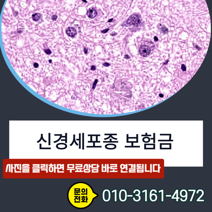  신경세포종 보험금, D43 코드인데 암진단비 받을 수 있을까?