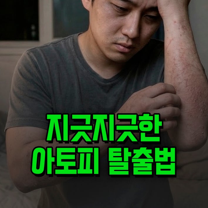 프로토픽 연고 0.1% 효능 부작용 총정리
