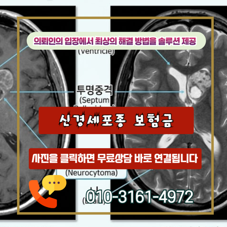  신경세포종 보험금, D43 코드인데 일반암 진단비 100% 받은 이유
