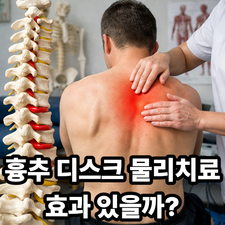  흉추 디스크 물리치료 효과 있을까? 실제 도움이 되는 이유
