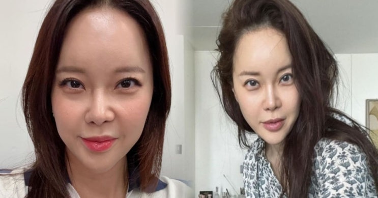  “성형 비용만 10억?” 백지영 눈·코 성형 고백… 뒤늦은 후회까지 솔직하게 털어놓은 이유