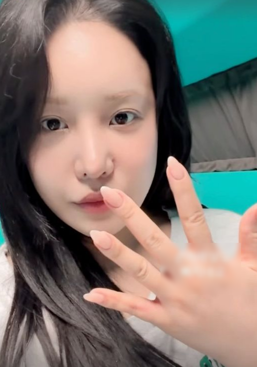  손가락 살마저 빠진 랄랄, 미모 리즈 인증한 비주얼 변신 공개