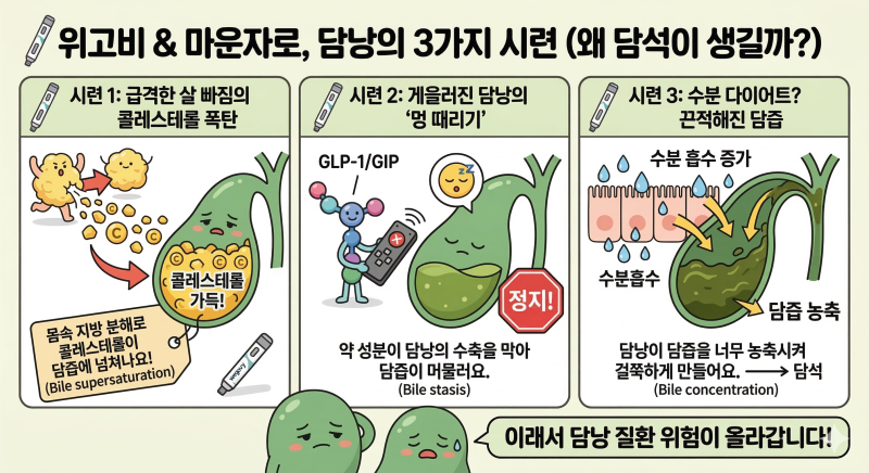 살은 쫙~ 담낭은 꽉! 위고비&마운자로 복용 시 담낭에 돌이 생기는 진짜 이유