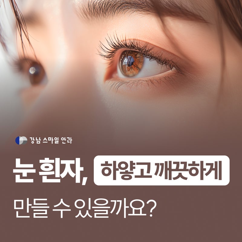 눈 흰자 하얗게 만드는 법? 3분만 읽어 보세요. 역삼동안과