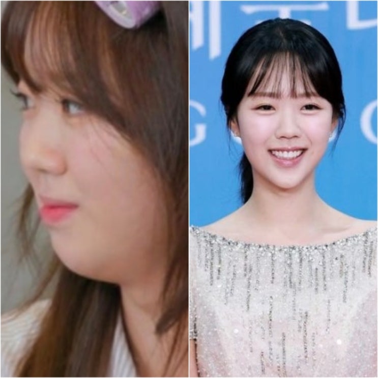  '요즘 예뻐졌다..?' 지예은 울쎄라 전후 얼굴 변화 화제