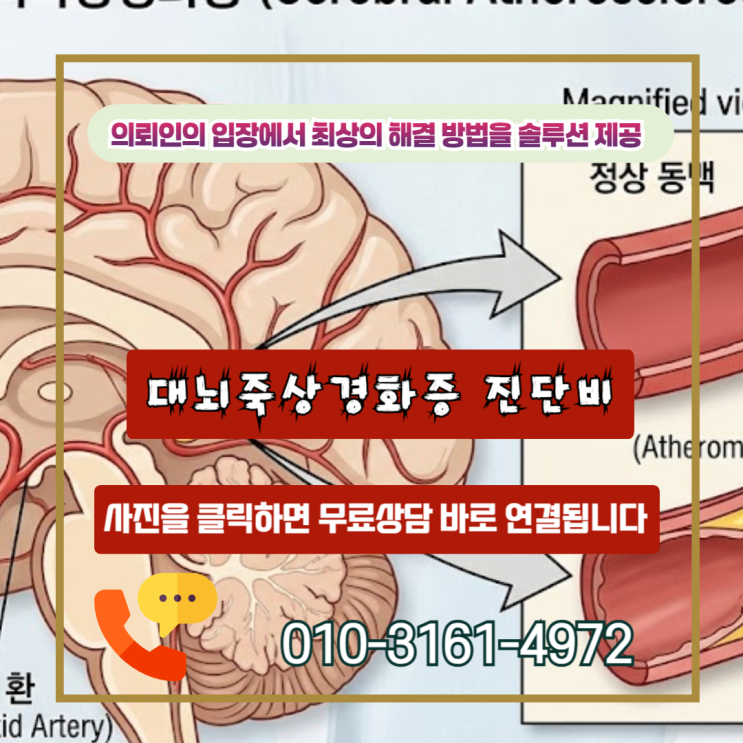  대뇌죽상경화증 진단비, 보험사가 거절하는 진짜 이유 (I67.2 핵심)