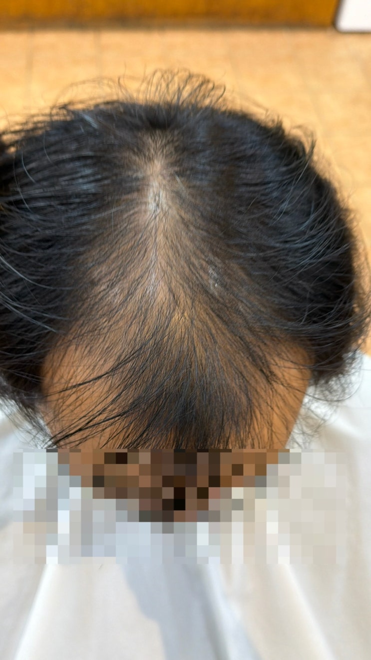  "이게 펌으로 된다고?" 부산 U자탈모인의 성지, 토탈성형펌으로 찾은 잃어버린 10년”토탈솔루션( 부산광역시사상구르네시떼미용실 )남천연제사직영도거제김해명지장유창원마산울산양산대연동래