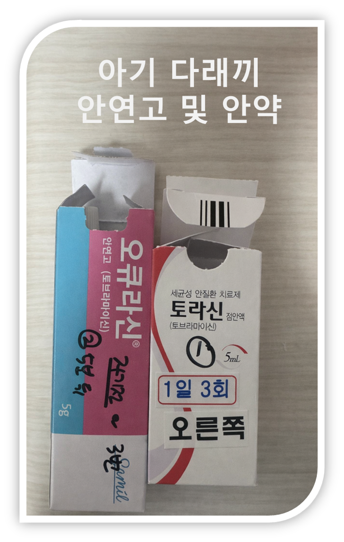 [안과] 4개월아기 다래끼로 소아과 및 안과 방문기록