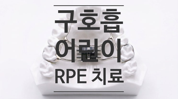  구호흡 하는 아이를 위한 상악확장 치료(RPE, RME), 8년 뒤에도 코호흡이 편안한 이유