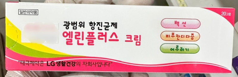 무좀약 2편) 라미실, 무조날이 듣지 않는다면?_(카네스텐크림, 엘린플러스 크림, 로세릴크림)