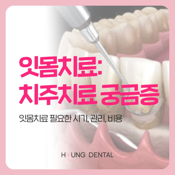  수원 망포역 치과가 답하는 잇몸치료 Q&A