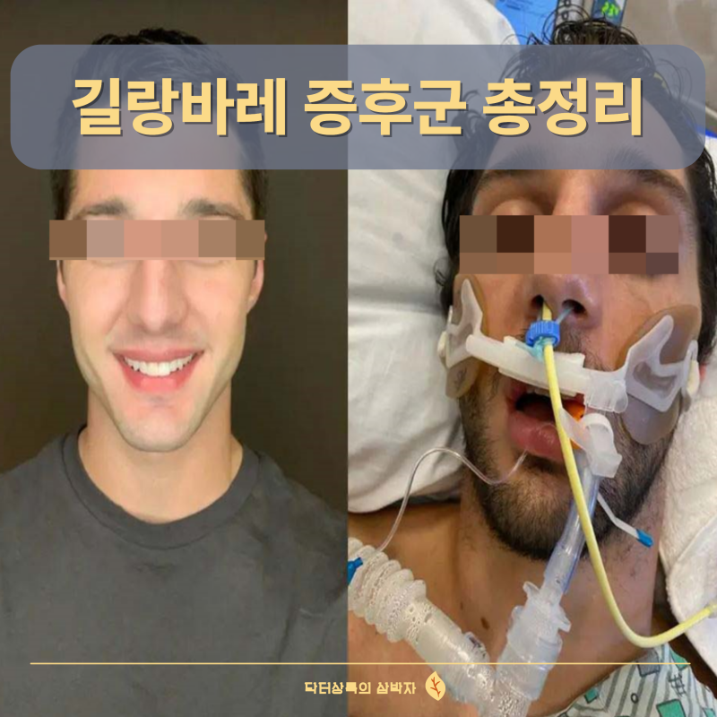길랑바레 증후군 원인 증상 예후 완치 재발 총정리