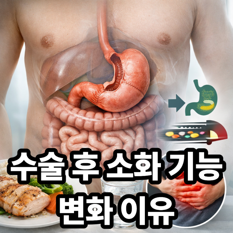  위암 수술 후 소화 기능 변화, 왜 달라질까?