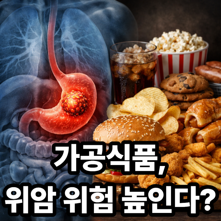  위암과 가공식품의 관계, 얼마나 위험할까? 꼭 알아야 할 핵심 정리