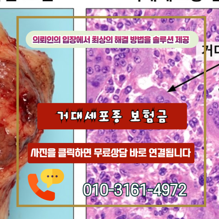  거대세포종 보험금, 양성인데도 암 진단비 받는 현실적인 방법
