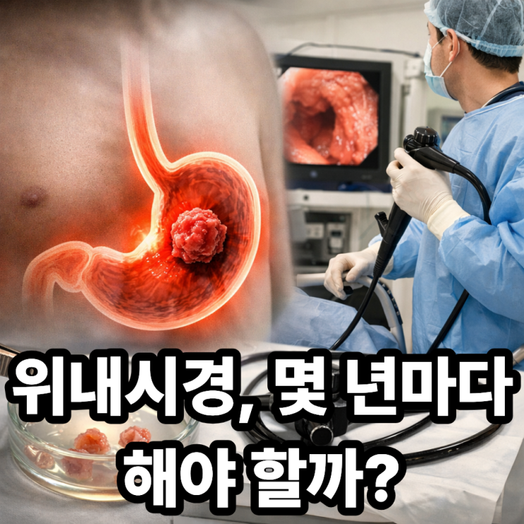  위암과 위내시경 검사 주기  언제 받아야 안전할까?