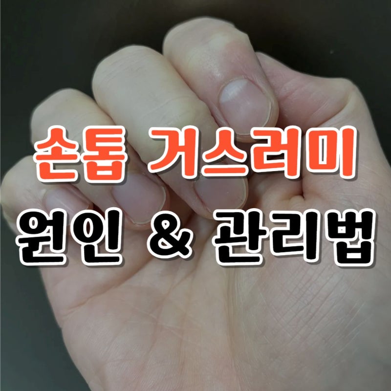 절대 물어뜯지 마세요! 손톱 거스러미 원인 & 염증 예방하는 관리법