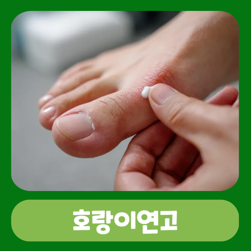 호랑이연고 종류 효능 효과 사용법