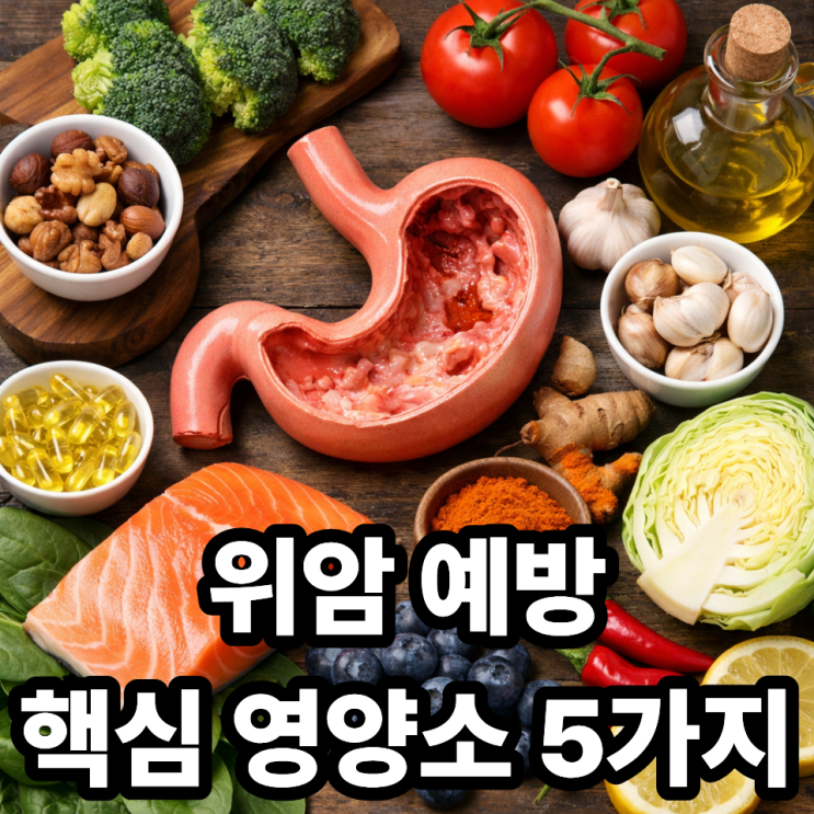  위암 예방에 좋은 영양소 TOP5, 꼭 챙겨야 하는 이유까지 정리