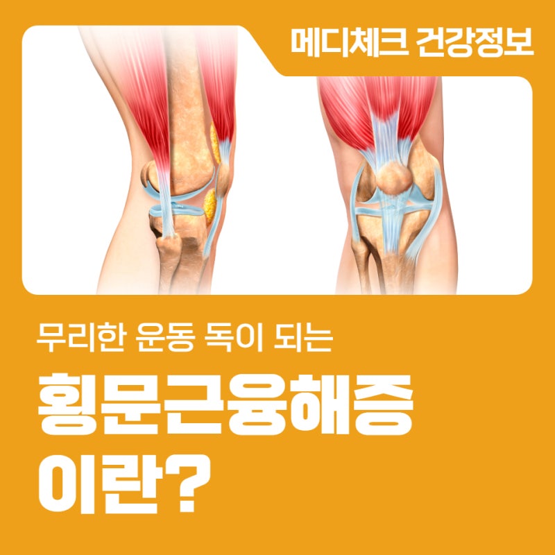 무리한 운동 독이 되는 횡문근융해증이란?