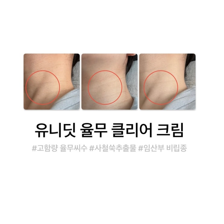 임산부 요철관리 율무크림효능 각질제거크림 피부결개선크림