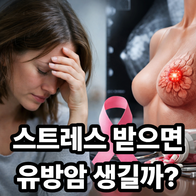  유방암과 스트레스의 관계, 실제 영향은?  팩트로 정리