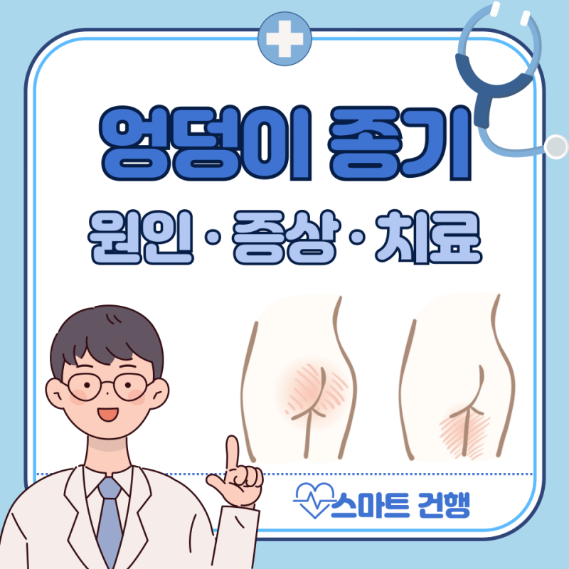 엉덩이 종기 원인, 연고, 약, 제거 치료법, 수술 : 병원 어디로