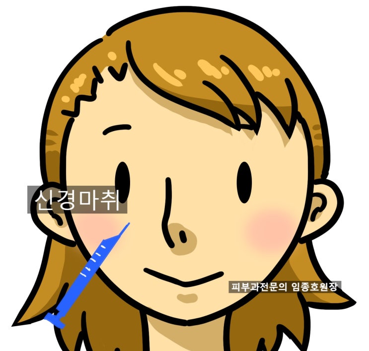 써마지 통증 줄이는 법 - 수면마취, 국소신경마취 (ver. 2026)