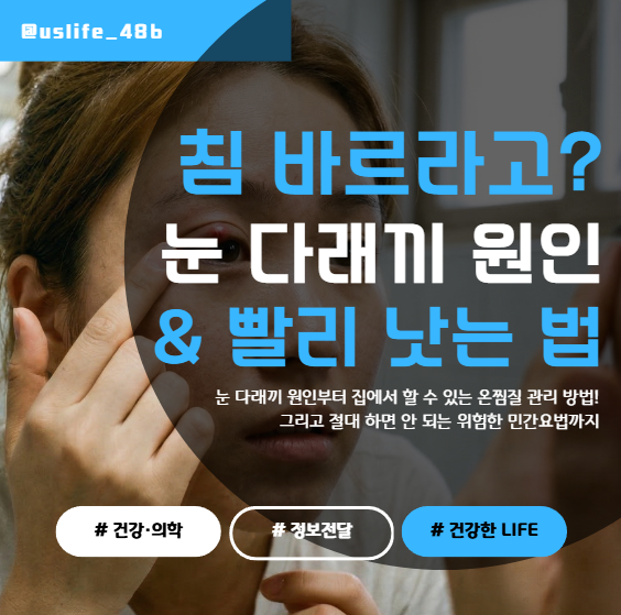 눈 다래끼 초기 증상 및 빨리 낫는 법 (온찜질 관리 꿀팁 대방출)