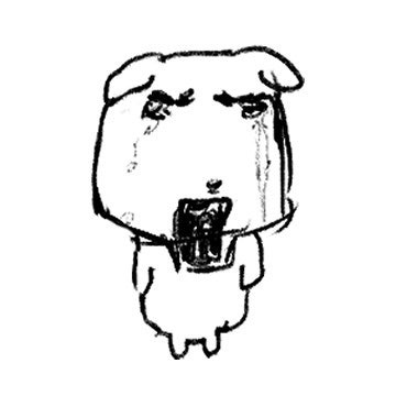 성인척추측만증 수술후기