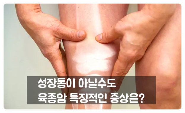뼈와 근육에 생기는 희귀암 골육종암, 육종암 초기증상부터 치료까지
