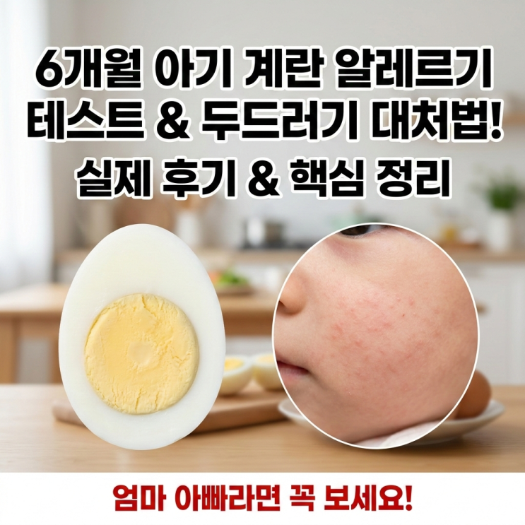  6개월 아기 계란 알레르기 테스트 순서(노른자 흰자) 및 두드러기 대처법 현실 후기