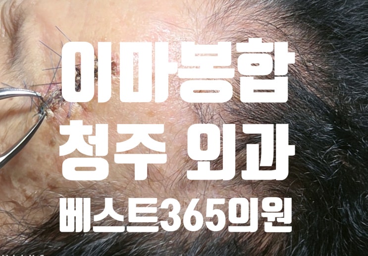  이마 찢어짐, 당황하지 마세요! 외과 전문의가 꼼꼼하게 봉합하는 야주말 진료 의원