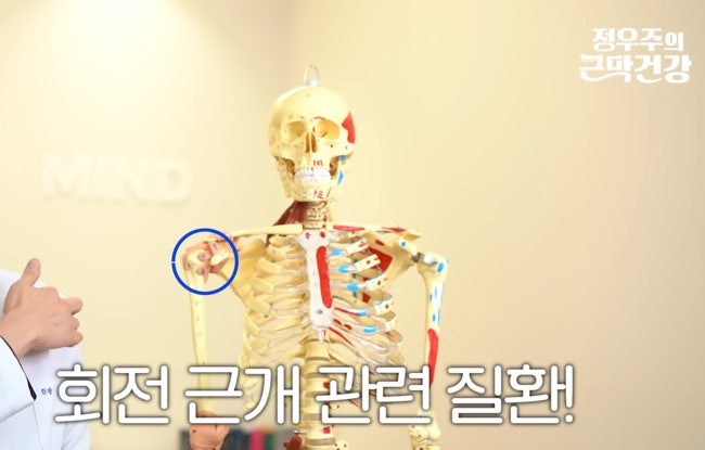 충돌증후근, 어깨통증, 회전근개 질환 : 근막이 문제? 마사지, 스트레칭방법 소개(1)