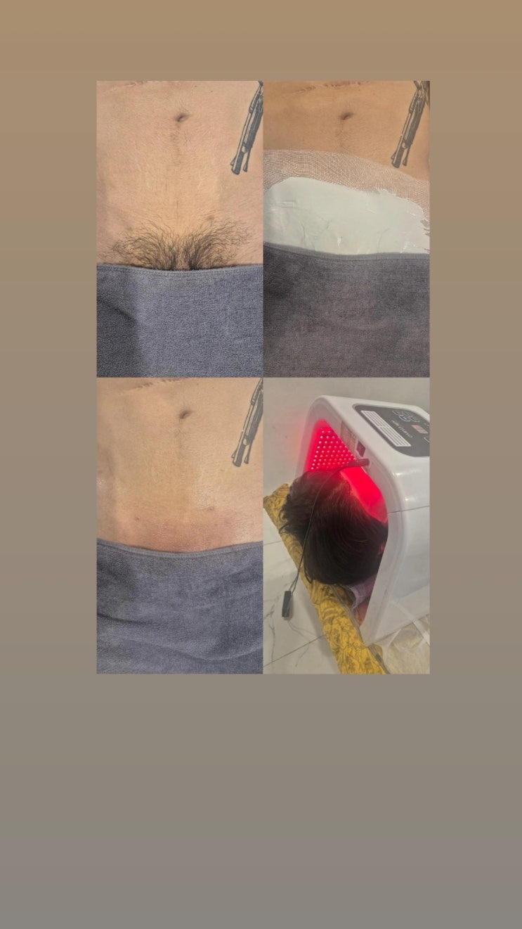  남자 브라질리언 왁싱은 남자 왁서가 맞춤 케어하는 영등포 왁싱샵 "청춘케어"