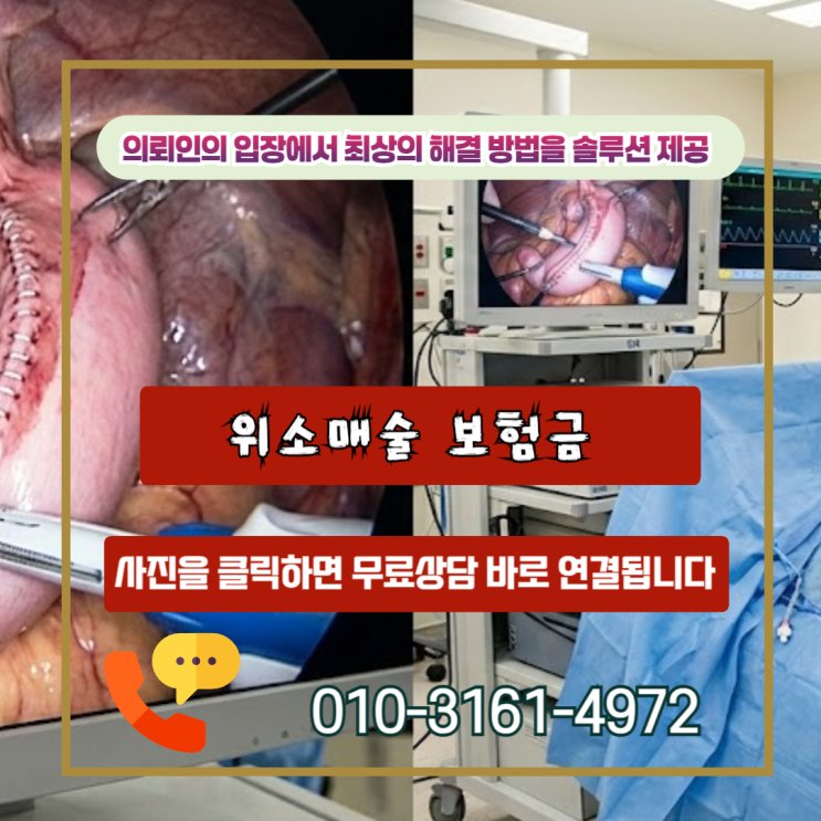  위소매술 보험금, 왜 나만 못 받을까? 실제로 대부분이 놓치는 결정적 이유