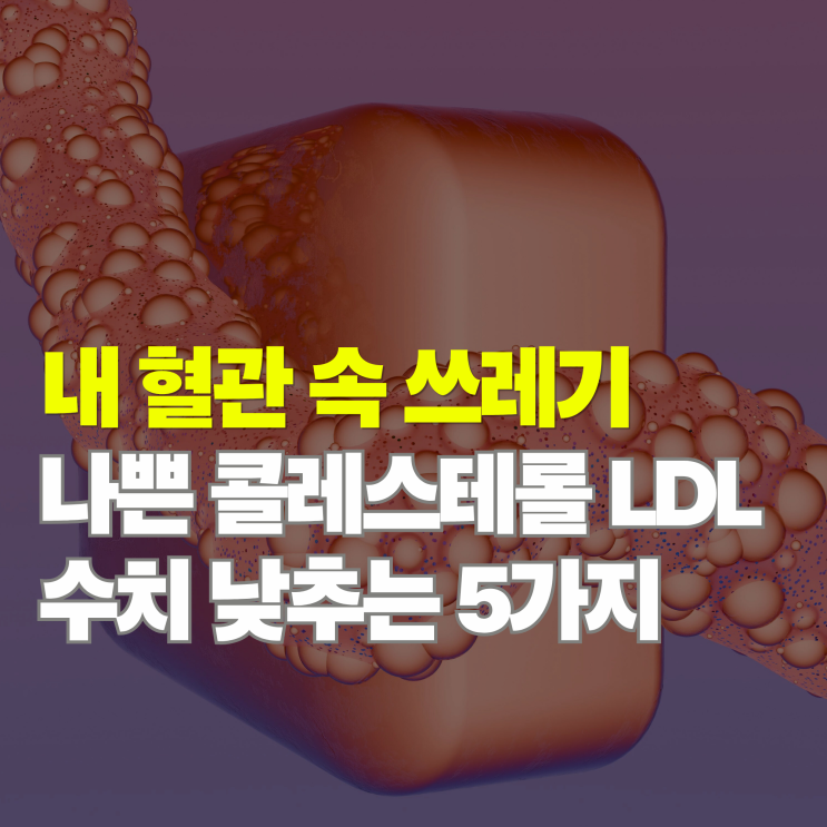  침묵의 살인자? 나쁜 콜레스테롤 LDL 수치 낮추는 법과 혈관 신호