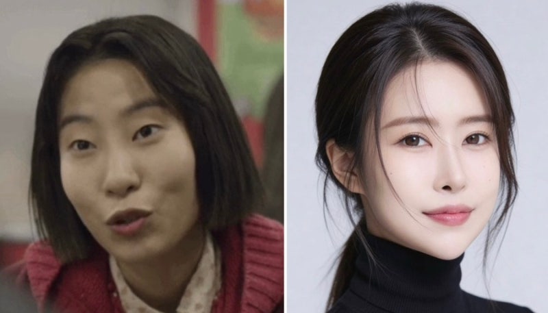 '성형에 1억 5천?' 개그맨 이세영 성형 전후, 벤츠 한 대 값 들여 완성한 외모 근황, 눈·코·가....