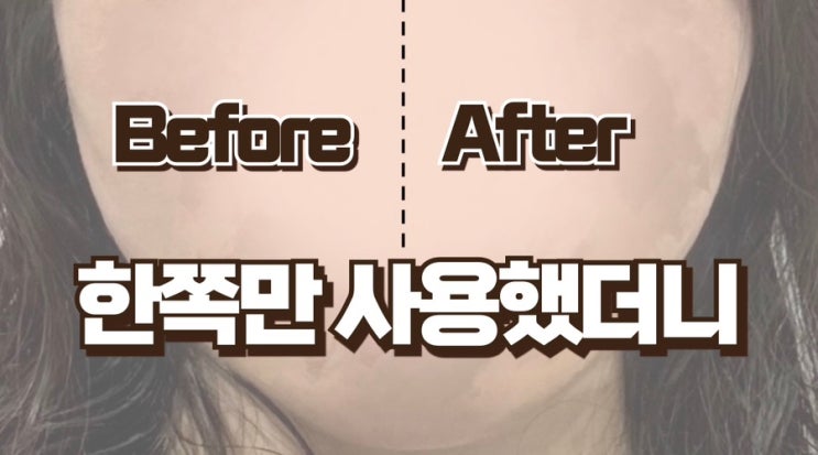  메디큐브 부스터프로X2 효과 비교 | 얼굴 반반 했더니 차이남 | 내돈내산