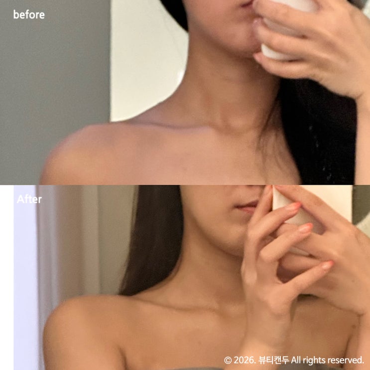  데콜테마사지 신부관리 신중동 웨딩케어 잘하는곳 에스테티아