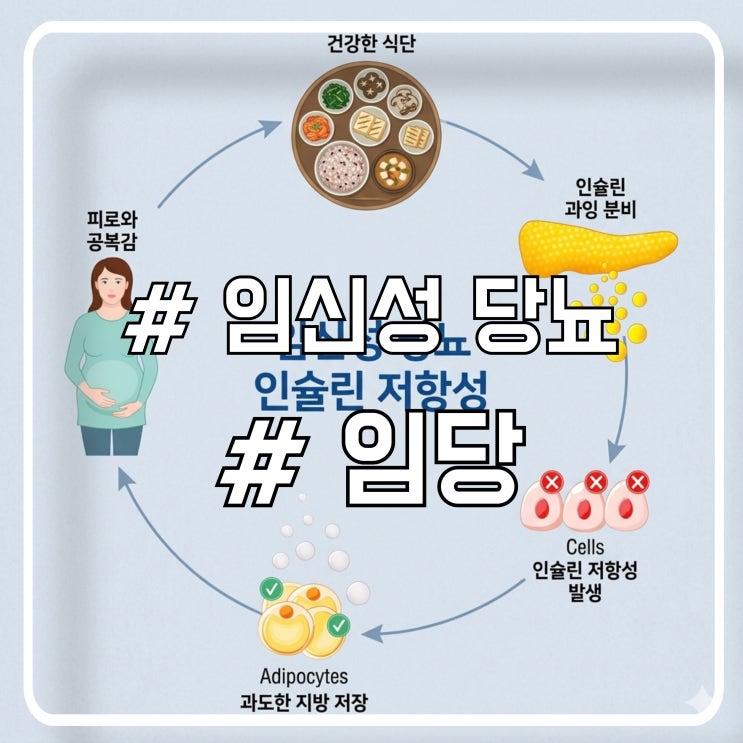 임당 관리 및 임당 검사 방법｜처음이라면 꼭 알아야 할 정보