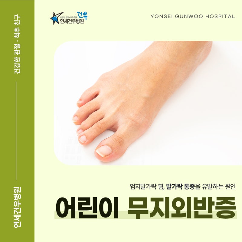 어린이 무지외반증 유전으로 의심되는 증상 구분은?